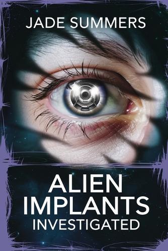 Alien Implants Investigated: (18 Aliens, Ufos, and Cryptids: Unraveling the Unknown)
