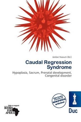 Caudal Regression Syndrome: (English)
