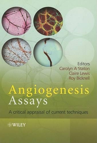 Angiogenesis Assays: A Critical Appraisal of Current Techniques