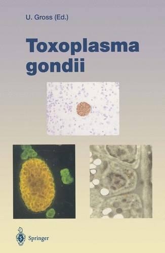 Toxoplasma Gondii