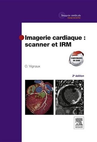 Imagerie Cardiaque: Scanner Et Irm