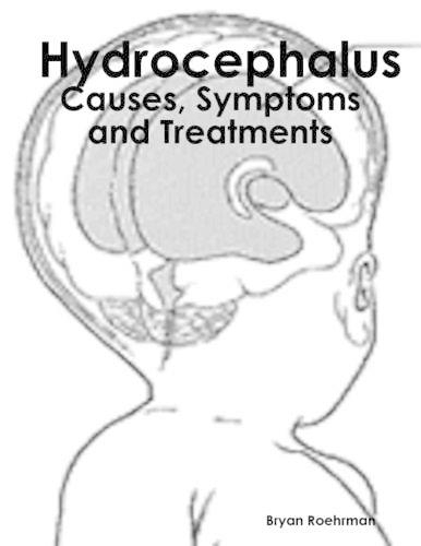 Hydrocephalus: Causes, Symptoms and Treatments