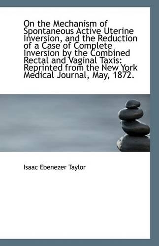 On the Mechanism of Spontaneous Active Uterine Inversion, and the Reduction of a Case of Complete in