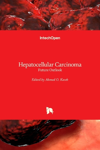 Hepatocellular Carcinoma