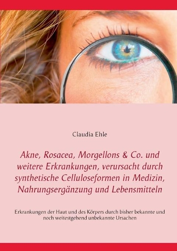 Akne, Rosacea, Morgellons & Co. und weitere Erkrankungen, verursacht durch synthetische Celluloseformen in Medizin, Nahrungsergänzung und Lebensmitteln