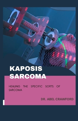 Kaposis Sarcoma