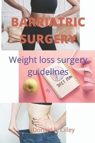 Barriatric Surgery: Weight loss surgery guidelines
