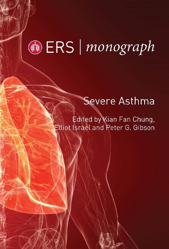Severe Asthma: (84 ERS Monograph)