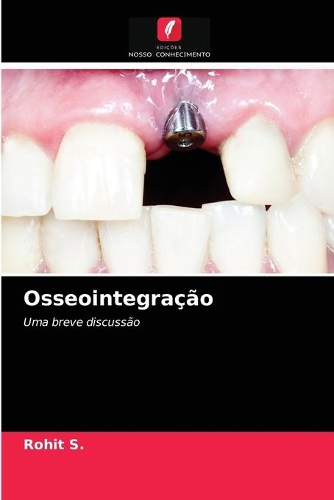 Osseointegração