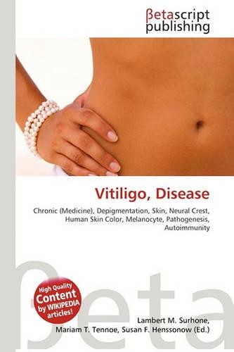 Vitiligo, Disease