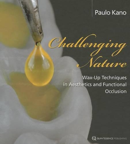 Challenging Nature: Wax-up Techniques in Aesthetics and Functional Occlusion