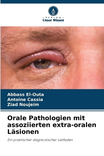 Orale Pathologien mit assoziierten extra-oralen Läsionen