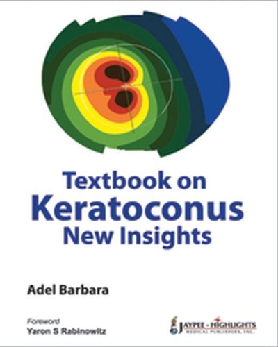Textbook on Keratoconus: New Insights(English)