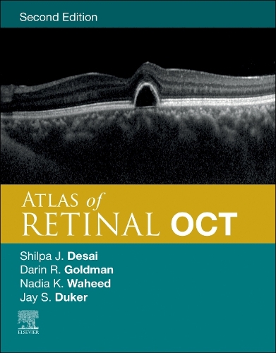 Atlas of Retinal Oct E-Book