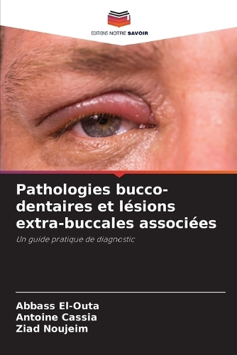 Pathologies bucco-dentaires et lésions extra-buccales associées