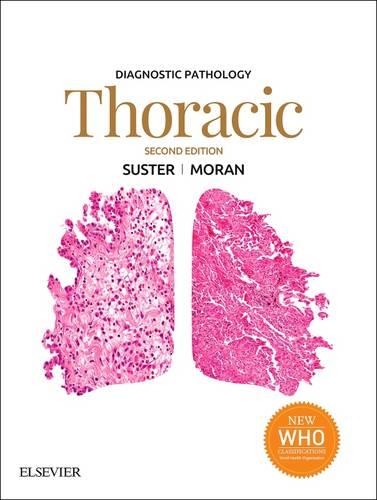 Diagnostic Pathology: Thoracic E-Book: Diagnostic Pathology: Thoracic E-Book(Diagnostic Pathology)