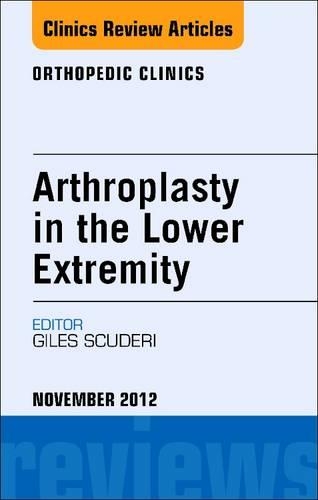 Arthroplasty in the Lower Extremity, an Issue of Orthopedic Clinics - E-Book: (43 Clinics: Orthopedics)