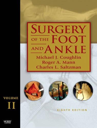 Surgery of the Foot and Ankle