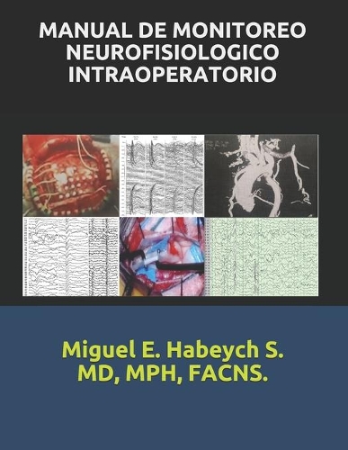 Manual de Monitoreo Neurofisiológico Intraoperatorio.
