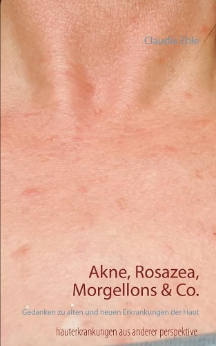 Akne, Rosazea, Morgellons & Co.
