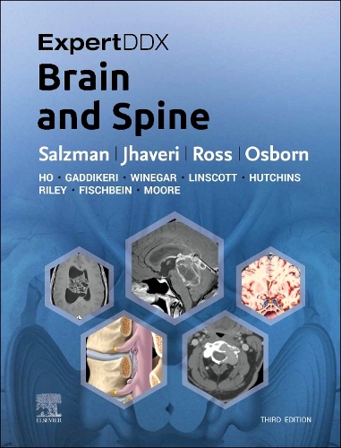 Expertddx: Brain and Spine E-Book: Expertddx: Brain and Spine E-Book(EXPERTddx)