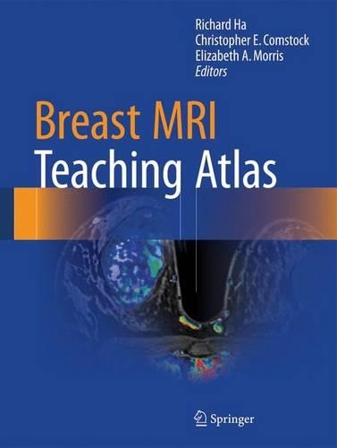Breast MRI Teaching Atlas