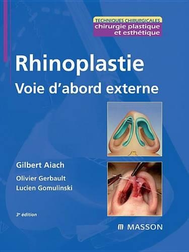 Rhinoplastie. Voie d'Abord Externe