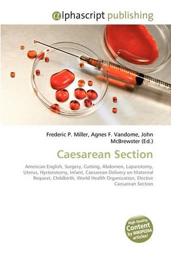 Caesarean Section