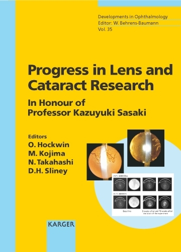 Progress in Lens and Cataract Research: In Honour of Professor Kazuyuki Sasaki(35 Developments in Ophthalmology)