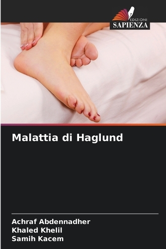 Malattia di Haglund