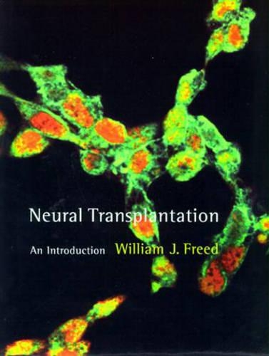 Neural Transplantation