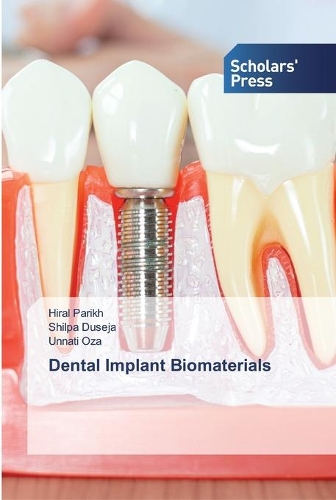 Dental Implant Biomaterials
