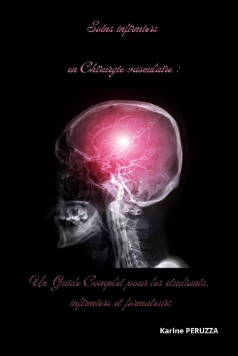 Soins infirmiers en Chirurgie vasculaire