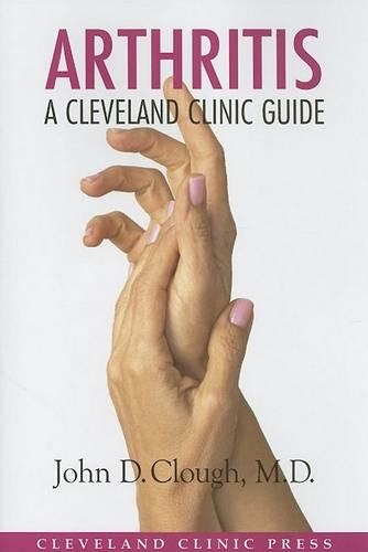 Arthritis: (Cleveland Clinic Guides)