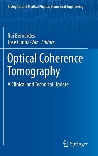 Optical Coherence Tomography