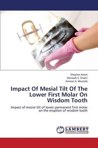 Impact of Mesial Tilt of the Lower First Molar on Wisdom Tooth: (English)