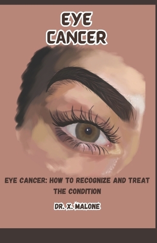Eye Cancer