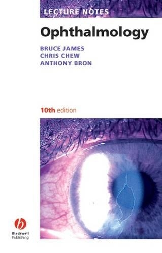 Lecture Notes: Ophthalmology: (Lecture Notes)