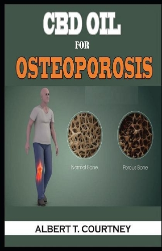 CBD Oil for Osteoporosis: Effective Remedy and Alternative Therapy for Osteoporosis