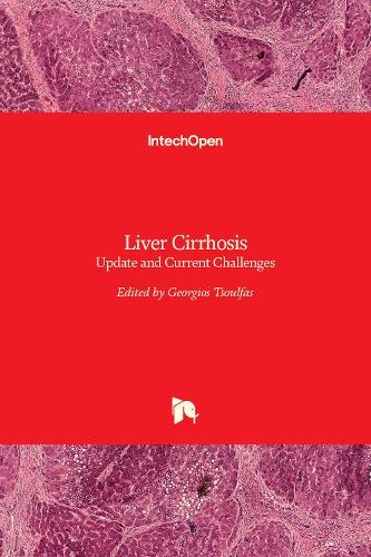 Liver Cirrhosis