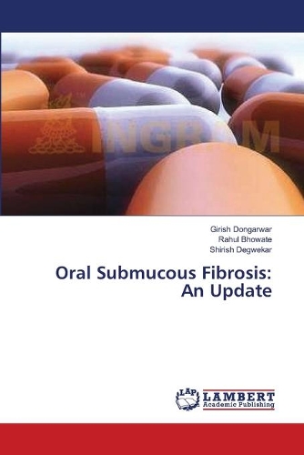 Oral Submucous Fibrosis: An Update(English)