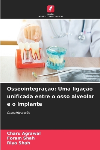 Osseointegração: Uma ligação unificada entre o osso alveolar e o implante
