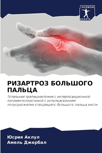 РИЗАРТРОЗ БОЛЬШОГО ПАЛЬЦА