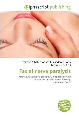 Facial Nerve Paralysis: (English)
