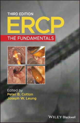 ERCP – The Fundamentals 3e