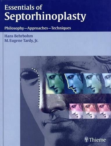 Essentials of Septorhinoplasty