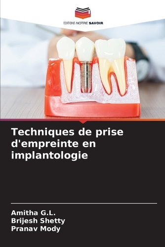 Techniques de prise d'empreinte en implantologie