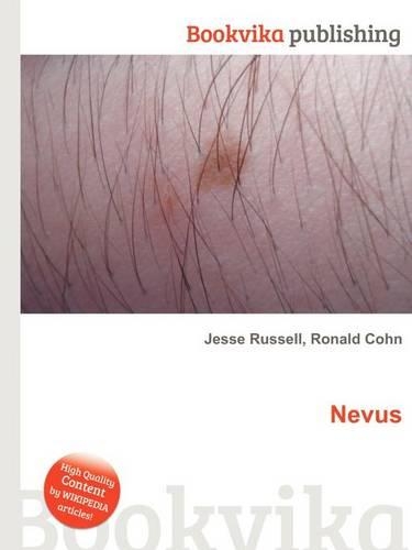 Nevus: (English)