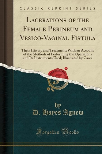 Lacerations of the Female Perineum and Vesico-Vaginal Fistula: Their History and Treatment; With an Account of the Methods of Performing the Operations and Its Instruments Used; Illustrated by Cases (Classic Reprint)