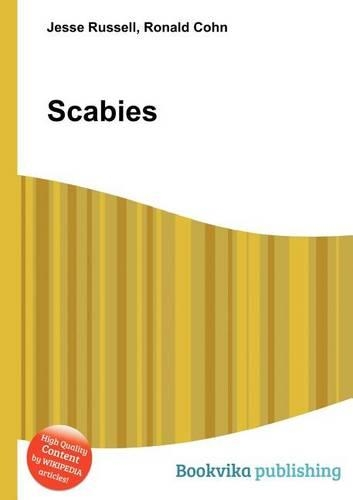 Scabies: (English)
